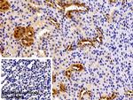 PKM2 Antibody in Immunohistochemistry (Paraffin) (IHC (P))