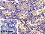 PKM2 Antibody in Immunohistochemistry (Paraffin) (IHC (P))