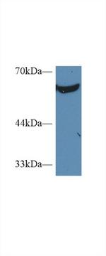 PKM2 Antibody in Western Blot (WB)