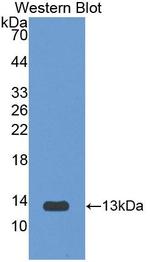 PKM2 Antibody in Western Blot (WB)