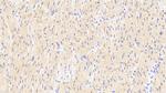 RANK (CD265) Antibody in Immunohistochemistry (Paraffin) (IHC (P))