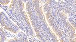 RANK (CD265) Antibody in Immunohistochemistry (Paraffin) (IHC (P))