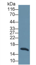 REG1B Antibody in Western Blot (WB)