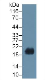 REG1B Antibody in Western Blot (WB)