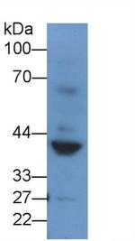 Renin Polyclonal Antibody