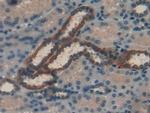 RBP1 Polyclonal Antibody