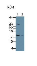 RBP1 Antibody in Western Blot (WB)