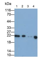 RBP4 Antibody in Western Blot (WB)