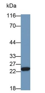 RBP4 Antibody in Western Blot (WB)