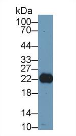 RBP4 Antibody in Western Blot (WB)