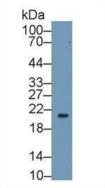 RBP4 Antibody in Western Blot (WB)