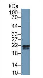 RBP4 Antibody in Western Blot (WB)