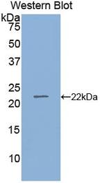 RBP4 Antibody in Western Blot (WB)