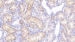RBP7 Polyclonal Antibody