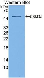 RS1 Antibody in Western Blot (WB)