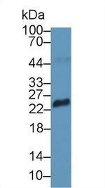 RS1 Polyclonal Antibody