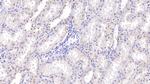 RNASE2 Polyclonal Antibody
