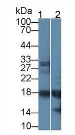 RNASE2 Antibody in Western Blot (WB)