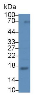 RNASE2 Antibody in Western Blot (WB)