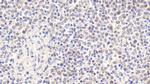 RNASEH2A Polyclonal Antibody