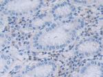 RNaseL Antibody in Immunohistochemistry (Paraffin) (IHC (P))