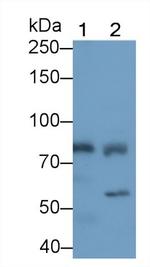 RNaseL Antibody in Western Blot (WB)