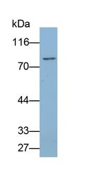 RNaseL Antibody in Western Blot (WB)