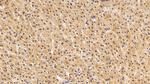 S100A6 Antibody in Immunohistochemistry (Paraffin) (IHC (P))