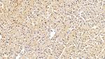 S100A6 Antibody in Immunohistochemistry (Paraffin) (IHC (P))