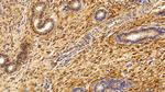 S100A6 Antibody in Immunohistochemistry (Paraffin) (IHC (P))