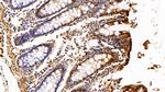 S100A6 Antibody in Immunohistochemistry (Paraffin) (IHC (P))