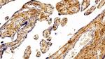 S100A6 Antibody in Immunohistochemistry (Paraffin) (IHC (P))