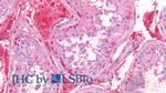 S100A6 Antibody in Immunohistochemistry (Paraffin) (IHC (P))