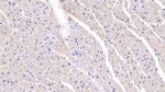 SEMA5B Polyclonal Antibody