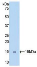 SEMA5B Antibody in Western Blot (WB)