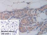 SHMT2 Antibody in Immunohistochemistry (Paraffin) (IHC (P))