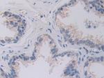 SHMT2 Antibody in Immunohistochemistry (Paraffin) (IHC (P))