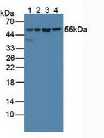 SHMT2 Antibody in Western Blot (WB)