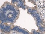 SPTLC1 Polyclonal Antibody