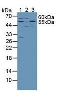 SPTLC1 Antibody in Western Blot (WB)