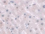 HAI-2 Polyclonal Antibody