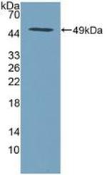 HAI-2 Antibody in Western Blot (WB)