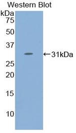 STAT4 Polyclonal Antibody