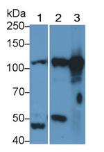 STAT5 beta Antibody in Western Blot (WB)