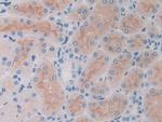 SLIT1 Antibody in Immunohistochemistry (Paraffin) (IHC (P))