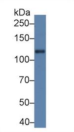 SLIT1 Antibody in Western Blot (WB)