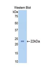 SLIT1 Antibody in Western Blot (WB)