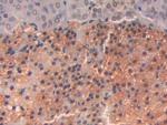 SLIT1 Antibody in Immunohistochemistry (Paraffin) (IHC (P))