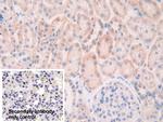 SLIT1 Polyclonal Antibody