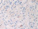 SLIT1 Antibody in Immunohistochemistry (Paraffin) (IHC (P))